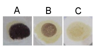 Iodine positive and negative test result examples